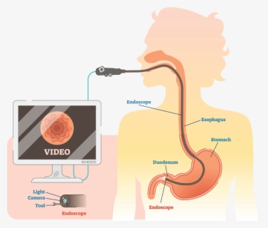 Ultrasound Medical - Ultrasound Icon Png , Free Transparent Clipart ...