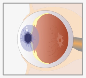 Human Eye Labelled Diagram , Free Transparent Clipart - ClipartKey