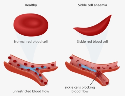 Red Cell Suspension Preparation , Free Transparent Clipart - ClipartKey