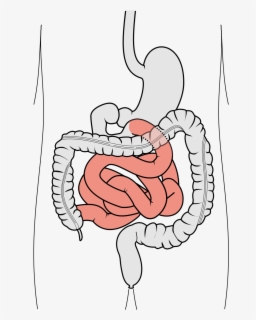 Jejunum And Ileum - Intestinum Png , Free Transparent Clipart - ClipartKey