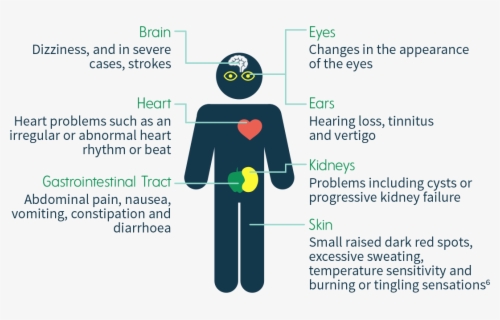 Disease Clipart Symptom - Fabry Disease Signs , Free Transparent ...