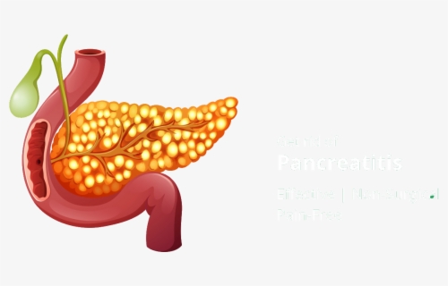 Homeopathic Treatment For Pancreatitis - Pancreas Illustration , Free ...